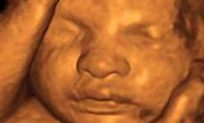 Home Ultrasound Gurgaon
